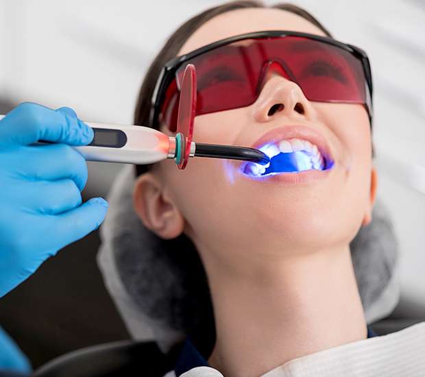 Las Vegas Professional Teeth Whitening