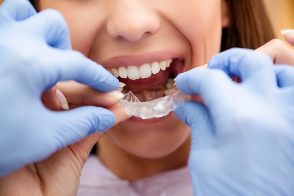 Why You Should Visit An Invisalign® Dentist Office